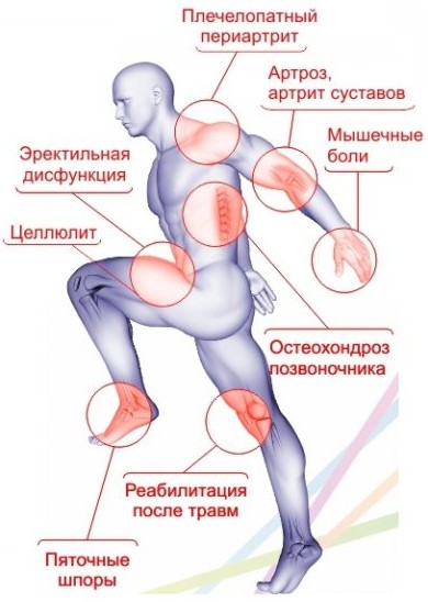 Ударно-волновая терапия в санатории им. академика И. П. Павлова